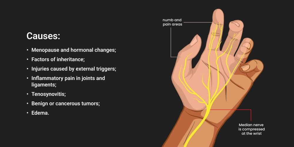 ipamorelin side effects carpal tunnel syndrome What is Carpal Tunnel Syndrome?